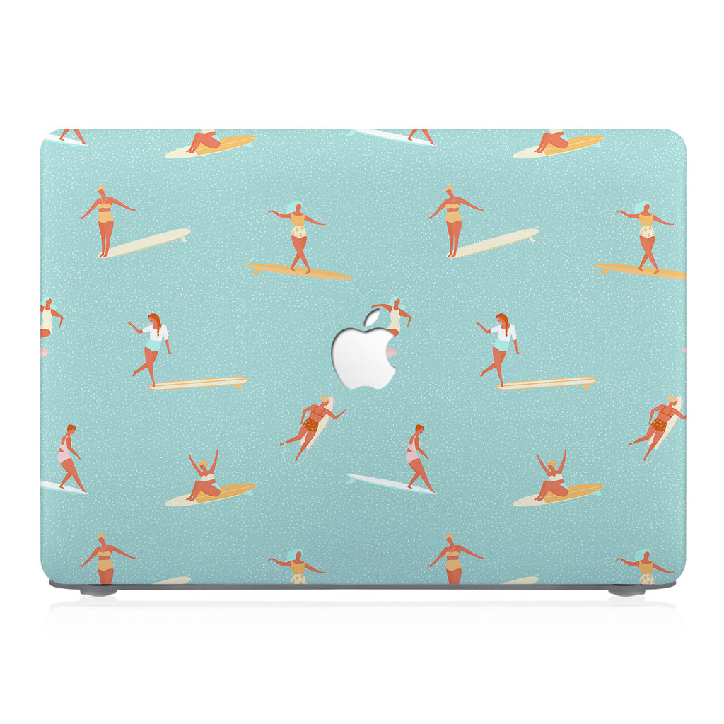 This lightweight, slim hardshell with 1 design is easy to install and fits closely to protect against scratches
