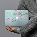 hardshell case with Marble design combines a sleek hardshell design with vibrant colors for stylish protection against scratches, dents, and bumps for your Macbook