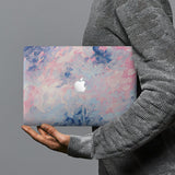 hardshell case with Oil Painting Abstract design combines a sleek hardshell design with vibrant colors for stylish protection against scratches, dents, and bumps for your Macbook
