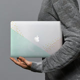 hardshell case with Geometric design combines a sleek hardshell design with vibrant colors for stylish protection against scratches, dents, and bumps for your Macbook