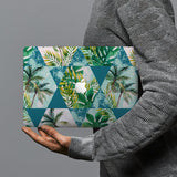 hardshell case with Tropical Leaves design combines a sleek hardshell design with vibrant colors for stylish protection against scratches, dents, and bumps for your Macbook