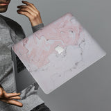 hardshell case with Pink Marble design holds up to scratches, punctures, and dents