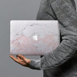 hardshell case with Pink Marble design combines a sleek hardshell design with vibrant colors for stylish protection against scratches, dents, and bumps for your Macbook