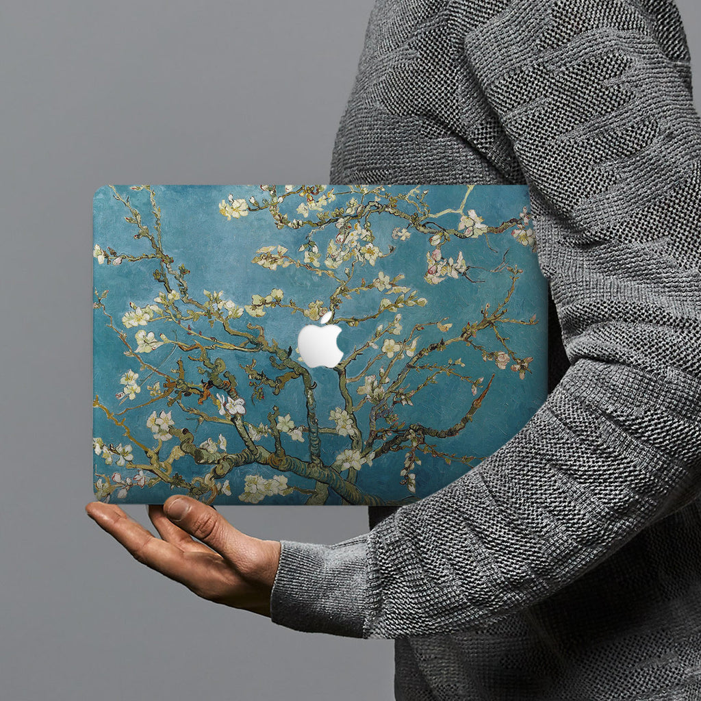 hardshell case with Oil Painting design combines a sleek hardshell design with vibrant colors for stylish protection against scratches, dents, and bumps for your Macbook