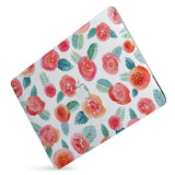 Protect your macbook  with the #1 best-selling hardshell case with Rose design